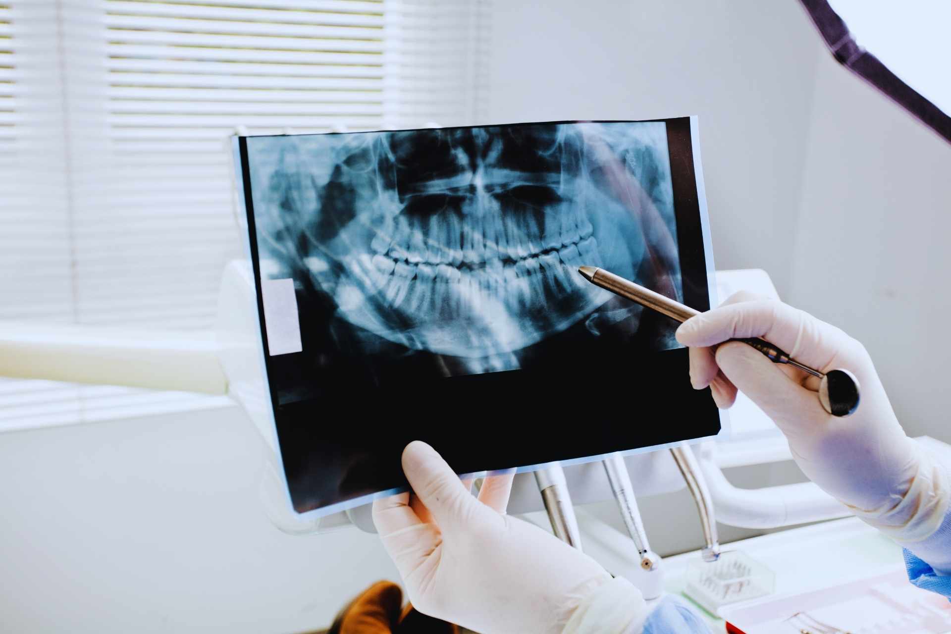 Radiografía dental en Hermosillo