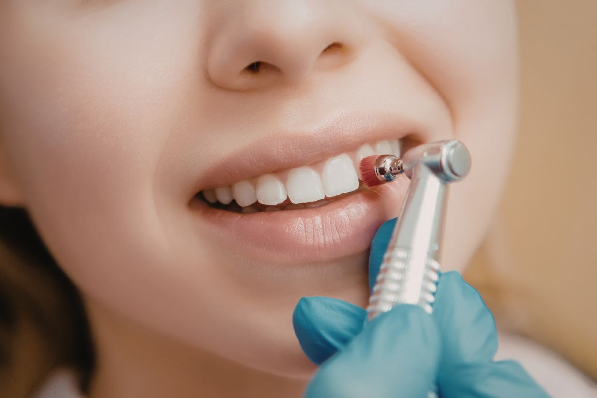 Limpieza profunda dental en Hermosillo