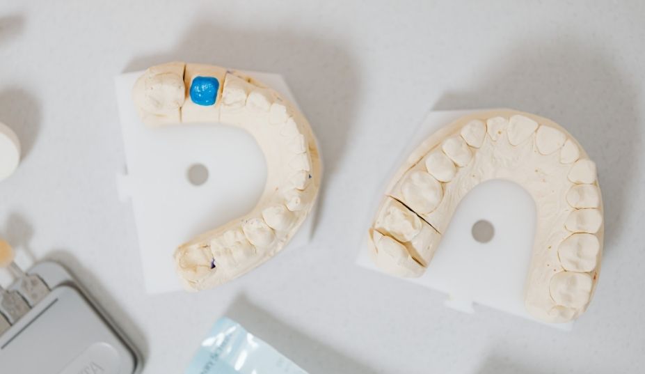 protesis-dental-en-hermosillo
